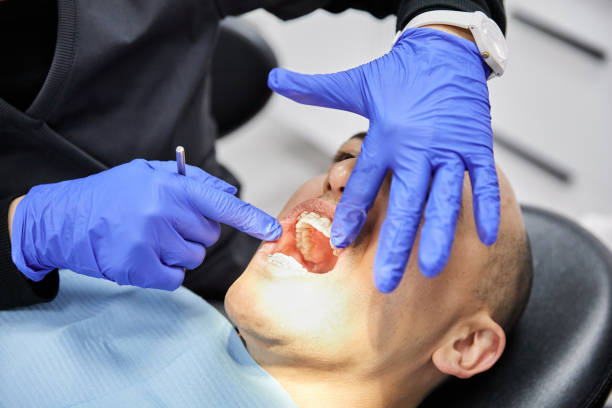 Best Emergency Dental Care for Broken or Chipped Teeth in Westville, OK